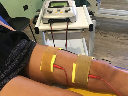 Elettrostimolazioni